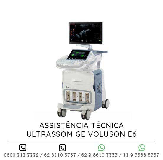 ASSISTENCIA-TECNICA-ULTRASSOM-GE-VOLUSON-E6